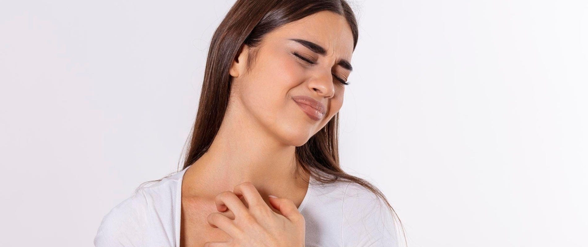 o que é dermatite por estresse